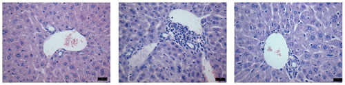 A partir da esquerda, imagem de fígado de animal que não desenvolveu a doença; órgão de camundongos com GVHD, com grande acúmulo de células inflamatórias; e fígado de animal submetido ao tratamento