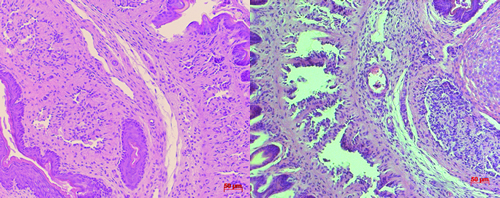 Imagens da análise histológica do tecido do pênis. À esquerda, o tecido antes da administração do peptídeo PnPP-19. Na imagem da direita, é possível visualizar, após a aplicação da substância, espaços em branco que indicam uma ereção
