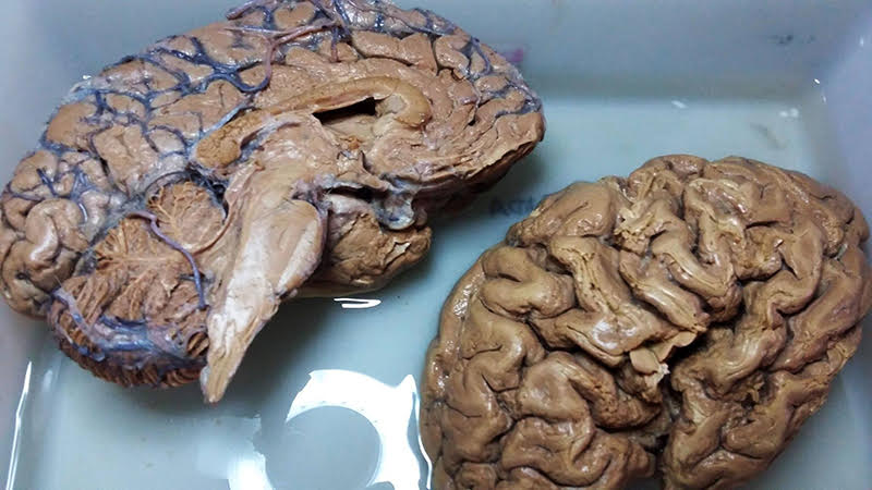 Resultado de imagem para cérebro humano